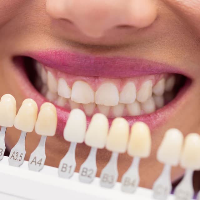 Tratamientos de estética dental en clínica de Vigo