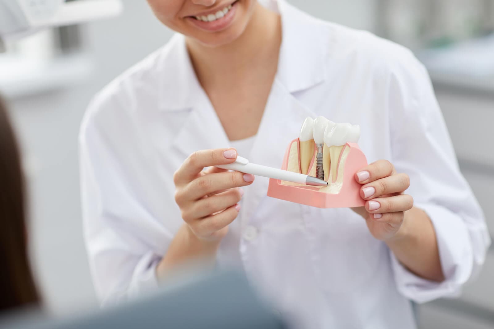 Clínica dental expertos en Implantes dentales