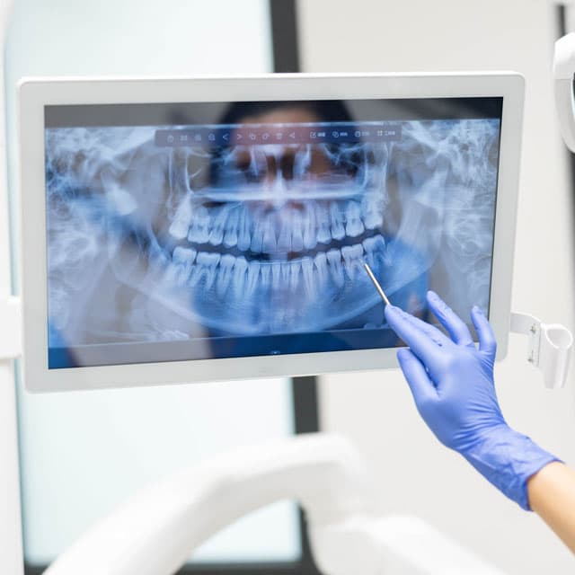 Radiología digital dental para diagnóstico preciso en Vigo C Dovaz